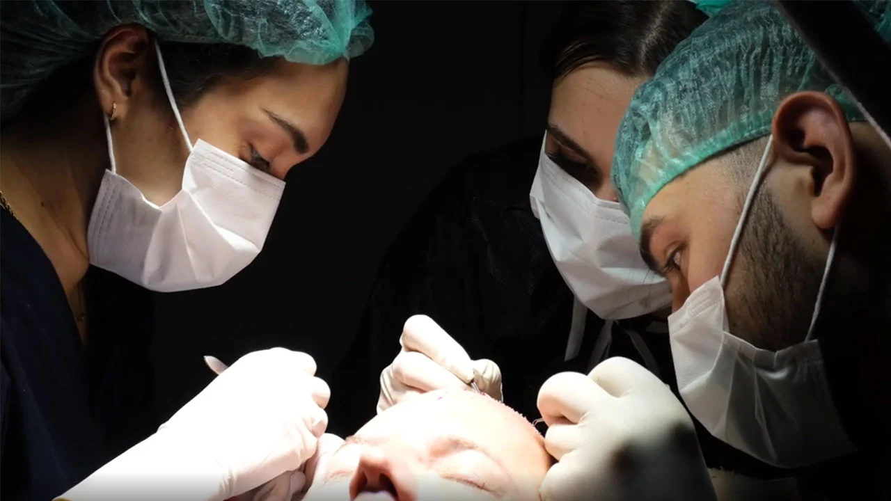 Hair transplant surgical team at Istanbul Vita Clinic