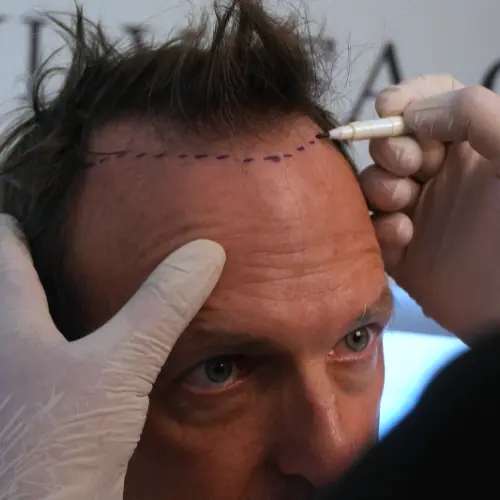 Istanbul Vita Exclusive Hair Analysis