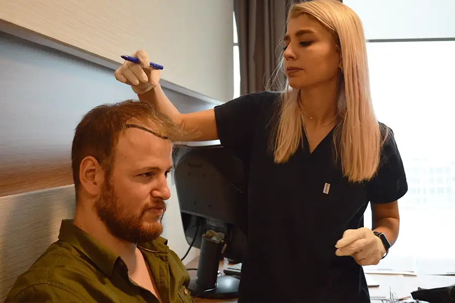 Sapphire Fue Hair Transplant Operation Planning