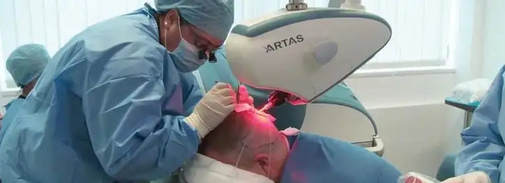Roboter Artas Haartransplantation 