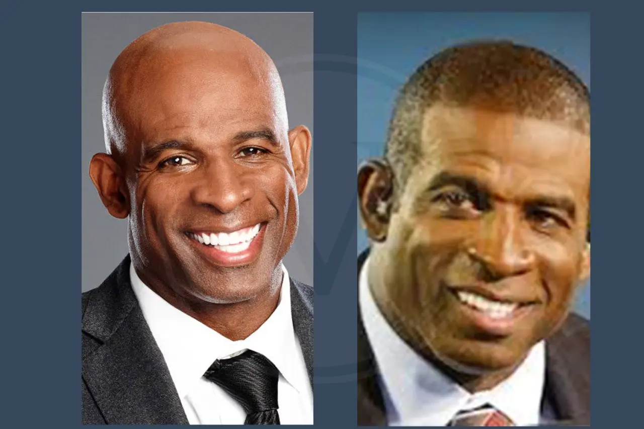 Celebrity Hair Transplant Deidon Sanders