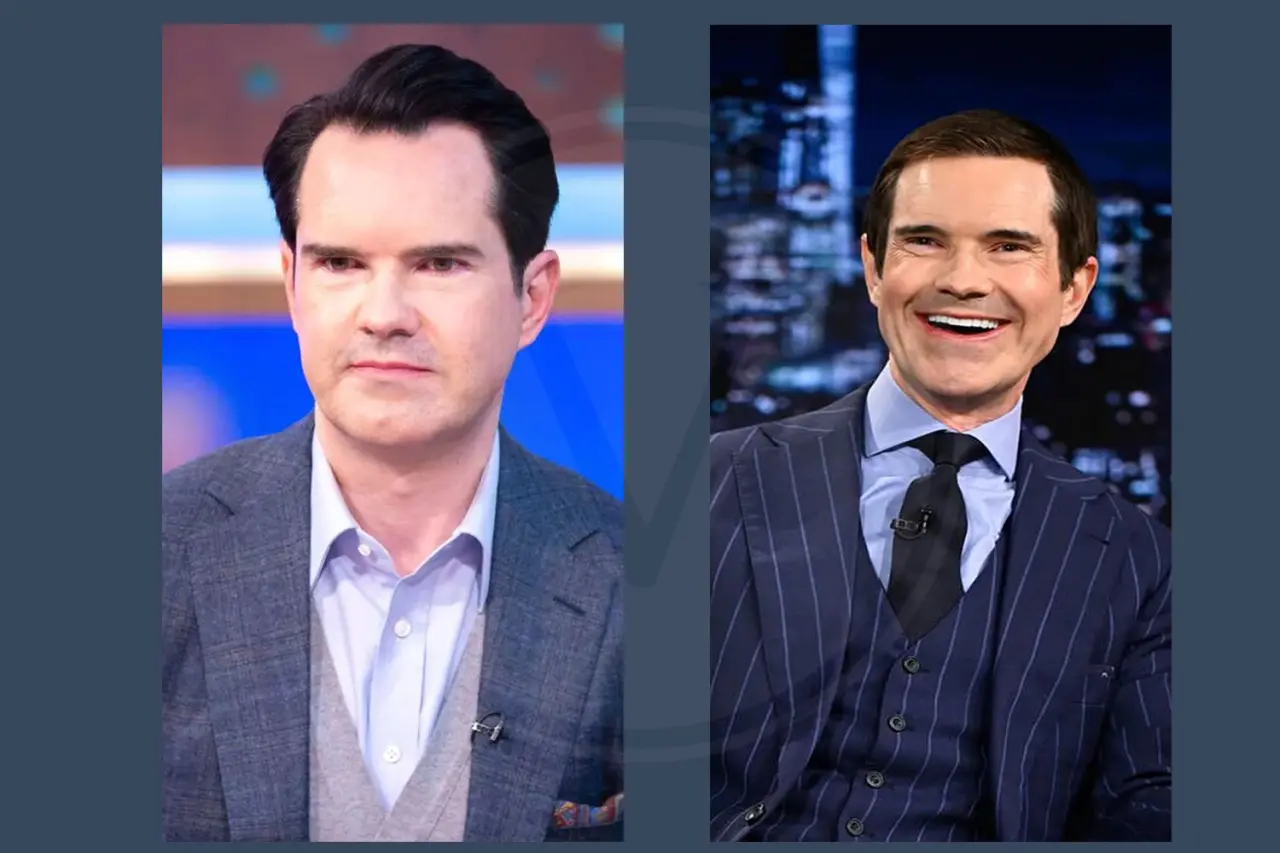 Celebrity Hair Transplant Jimmy Karr