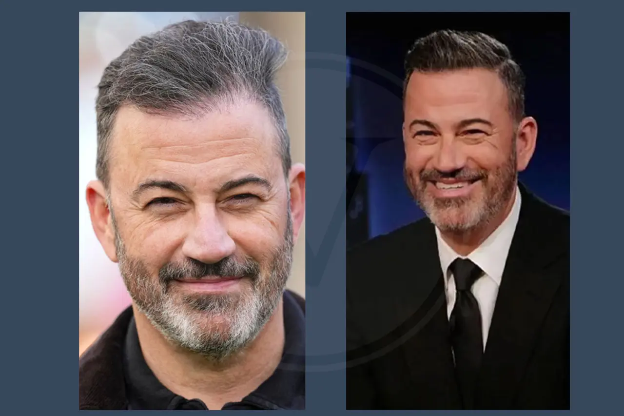 Celebrity Hair Transplant Jimmy Kimmel