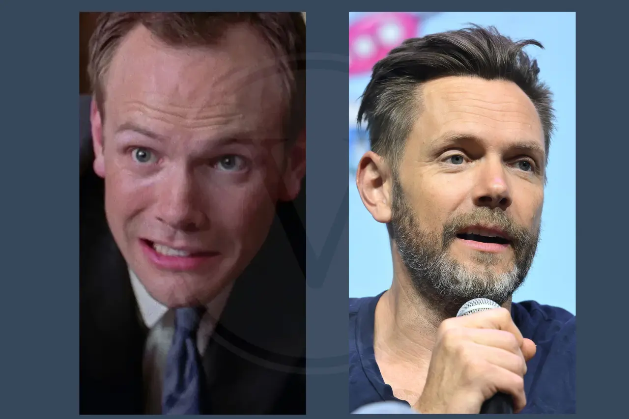 Celebrity Hair Transplant Joel Mchale