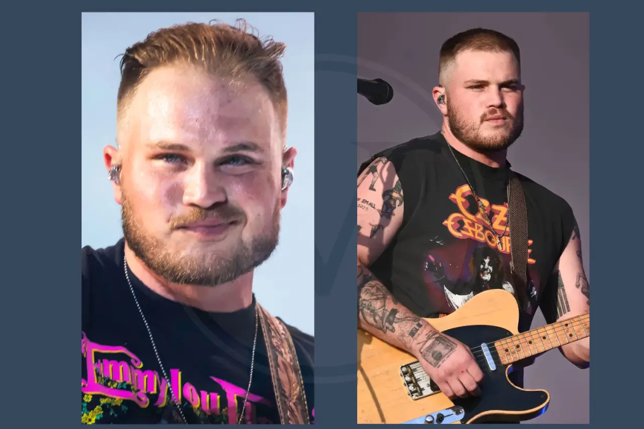 Celebrity Hair Transplant Zach Bryan