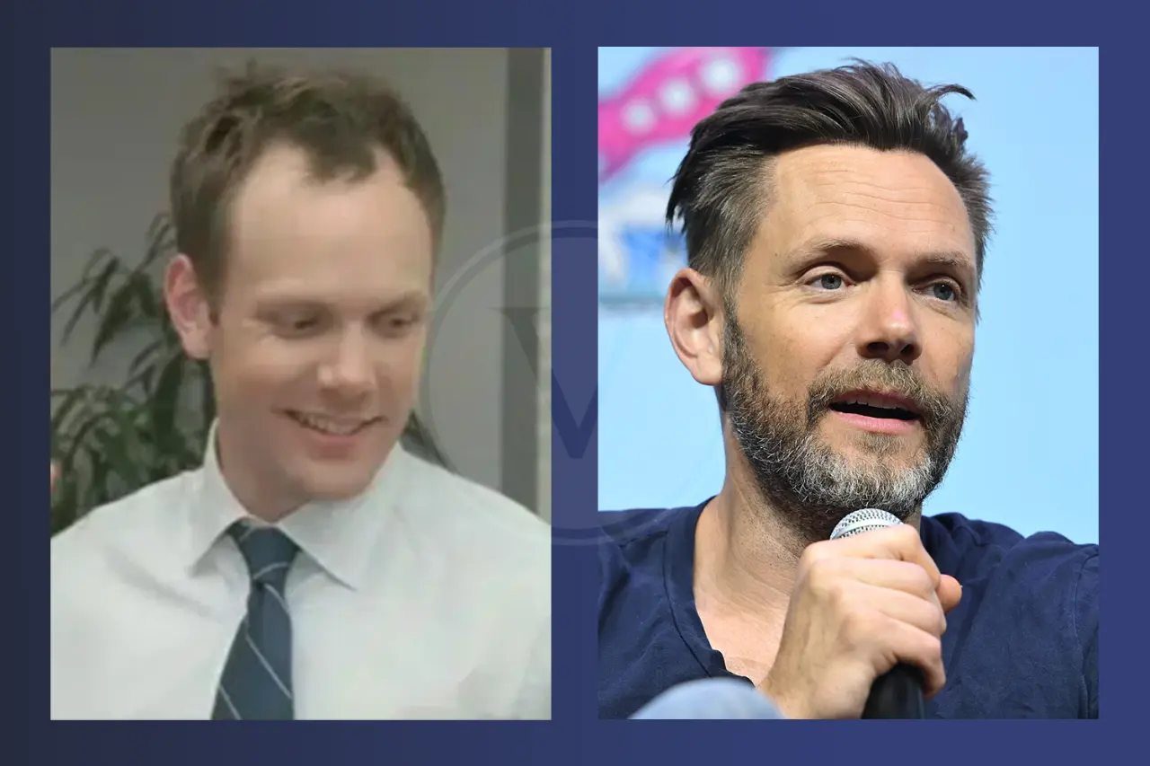 Joel McHale Before and After Hair Transplant