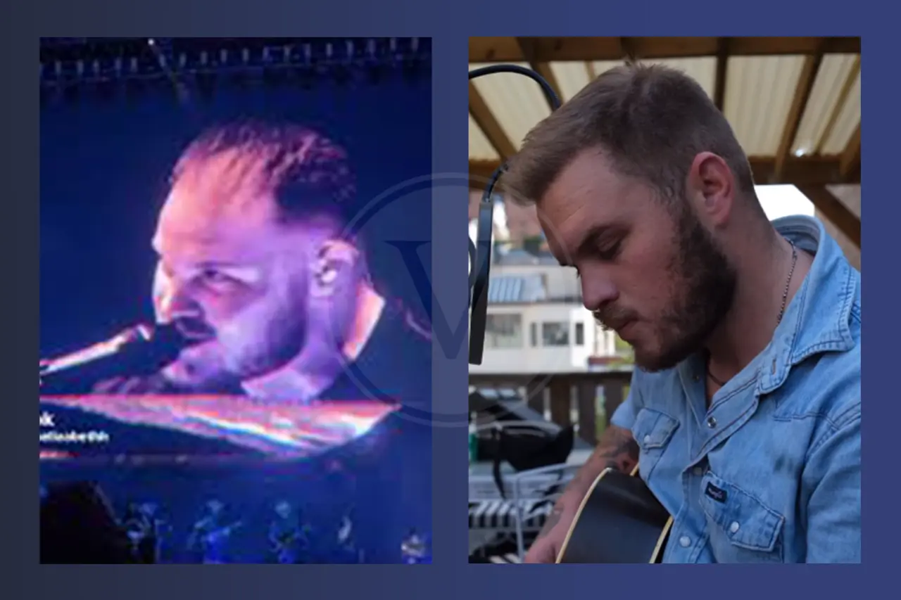 Zach Bryan Before And After Hair Transplant