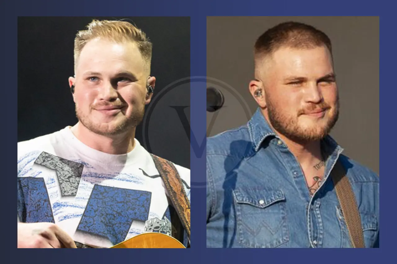 Zach Bryan Before And After Hair Transplant