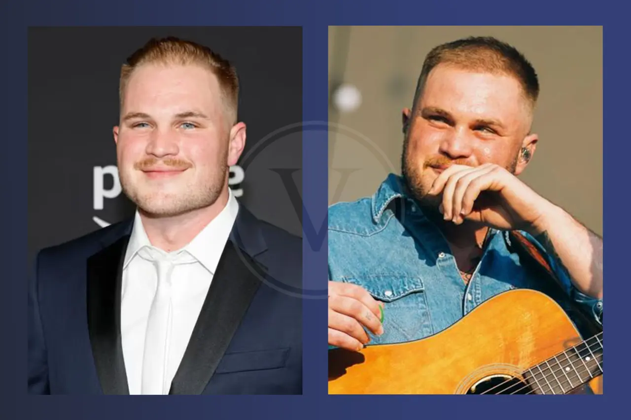 Zach Bryan Before And After Hair Transplant