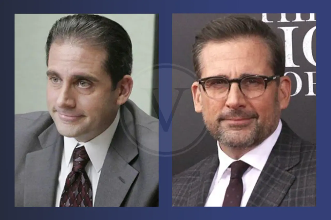 Steve Carell Before and After Hair Transplant