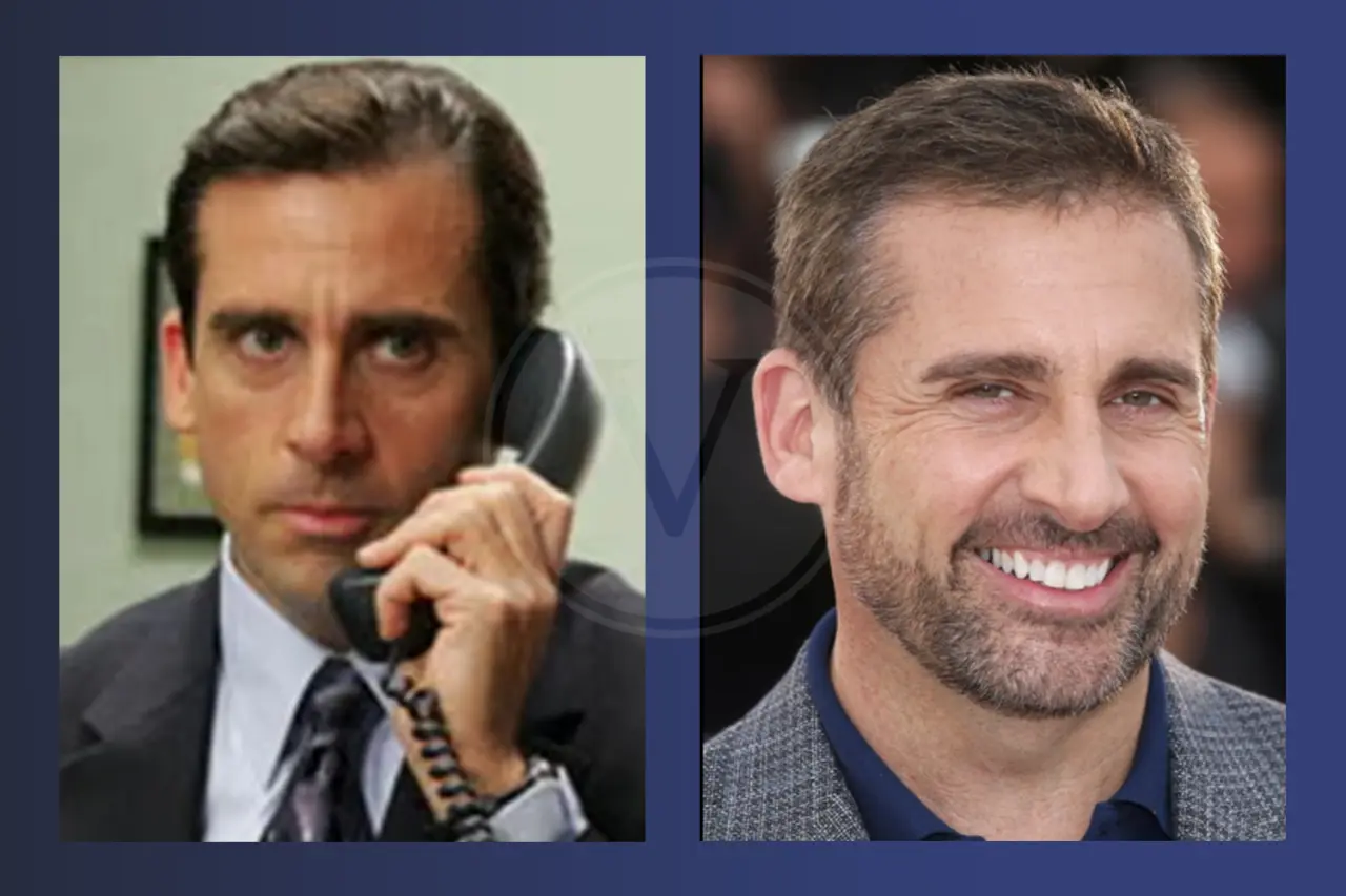 Steve Carell Before and After Hair Transplant