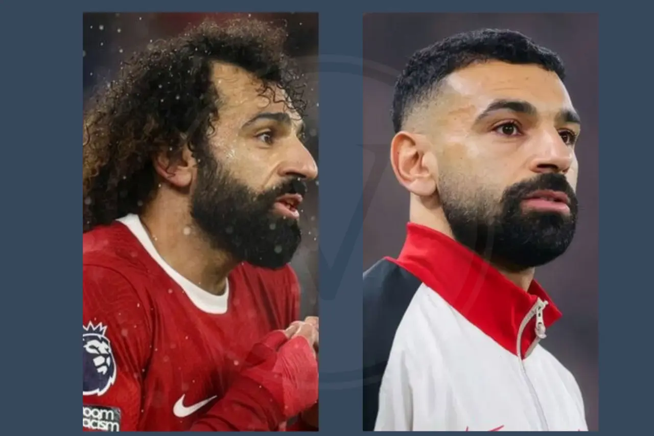 Mo Salah Before and After Hair Transplant