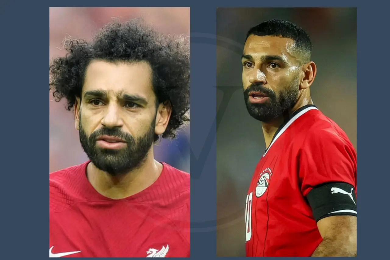 Mo Salah Before and After Hair Transplant