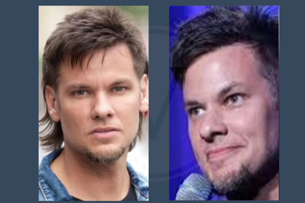 Celebrity Hair Transplant Theo Von