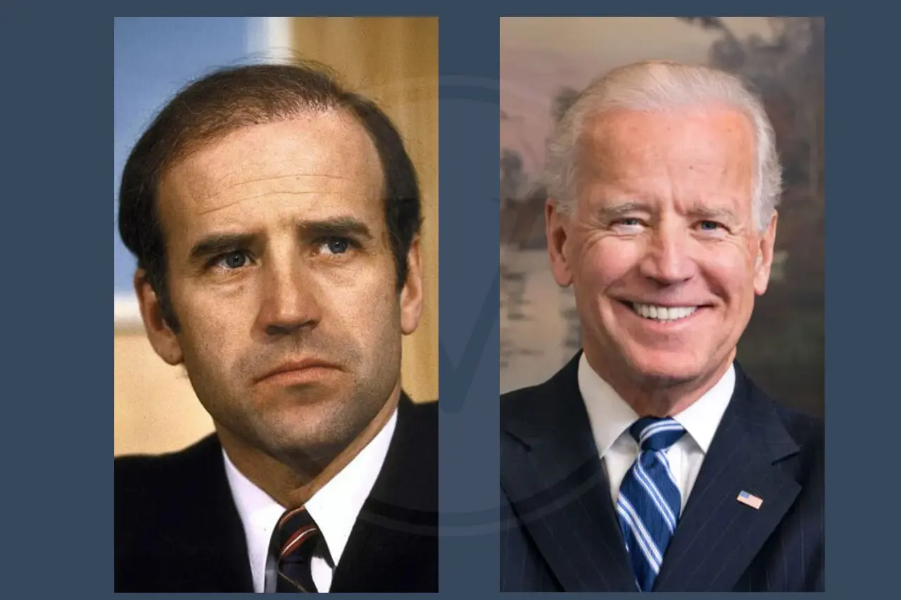 Joe Biden Before and After Hair Transplant