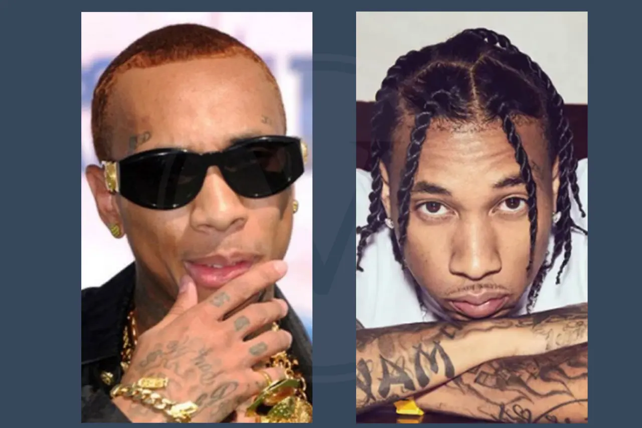 Tyga Before and After Hair Transplant