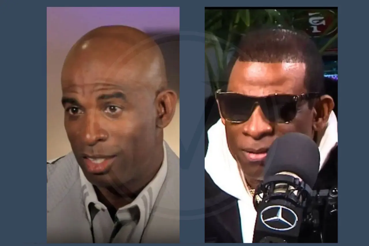 Deion Sanders Before and After Hair Transplant
