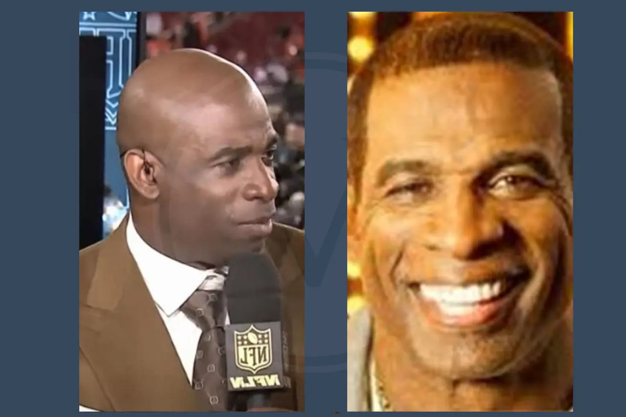 Deion Sanders Before and After Hair Transplant