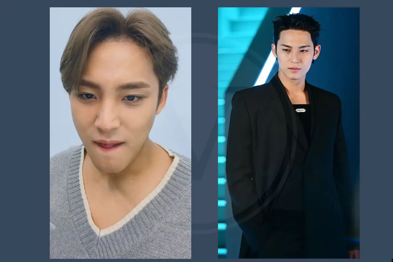 Seventeen Kim Mingyu Before and After Hair Transplant