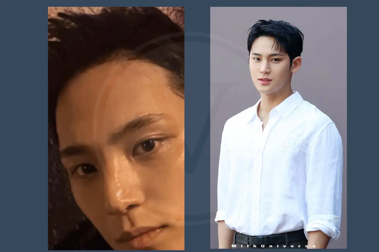 Seventeen Kim Mingyu Before and After Hair Transplant