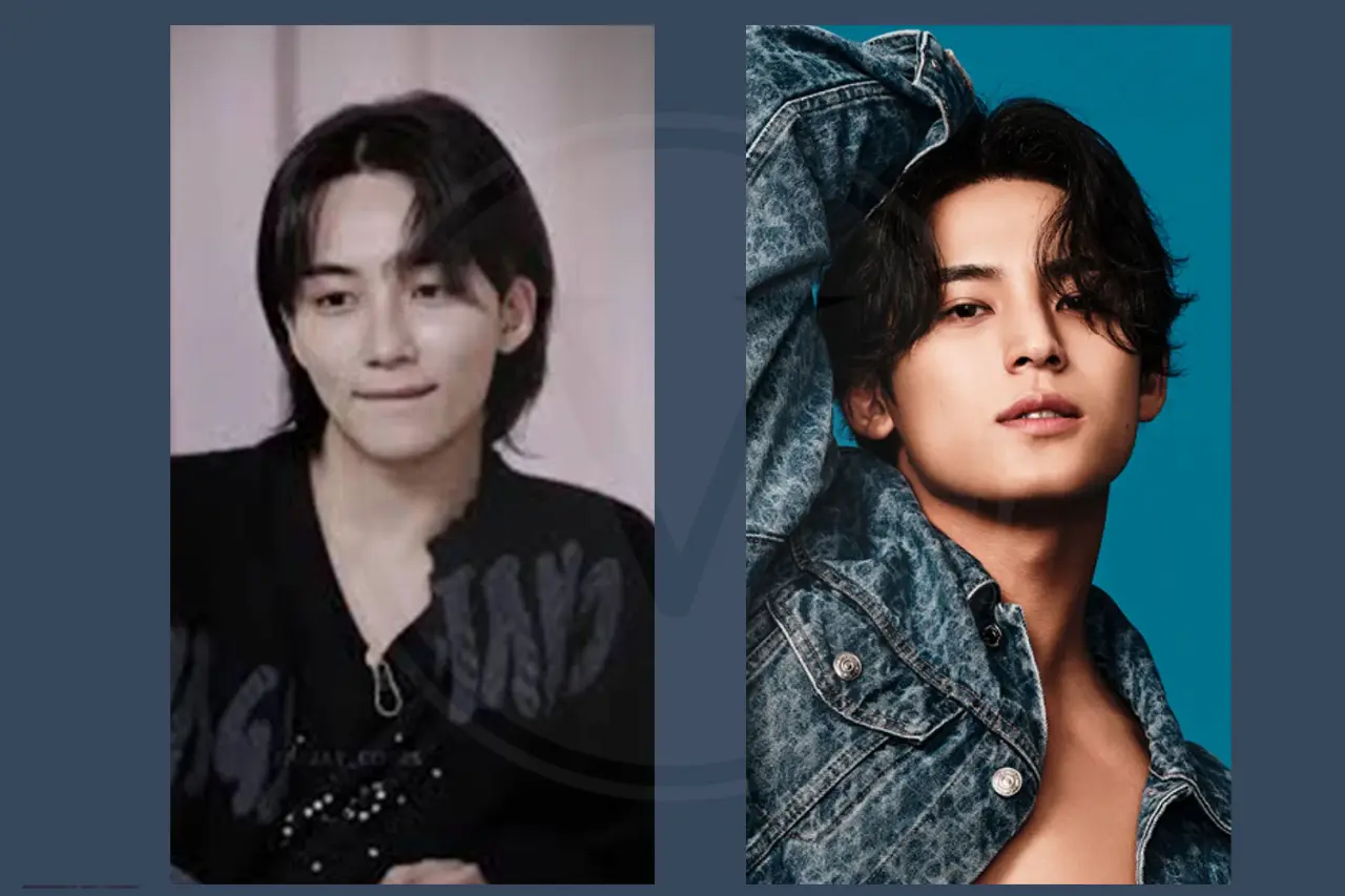 Celebrity Hair Transplant Kim Mingyu