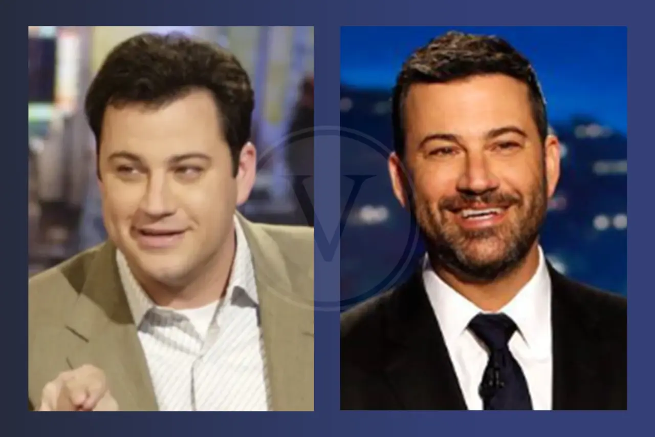 Jimmy Kimmel Before and After Hair Transplant