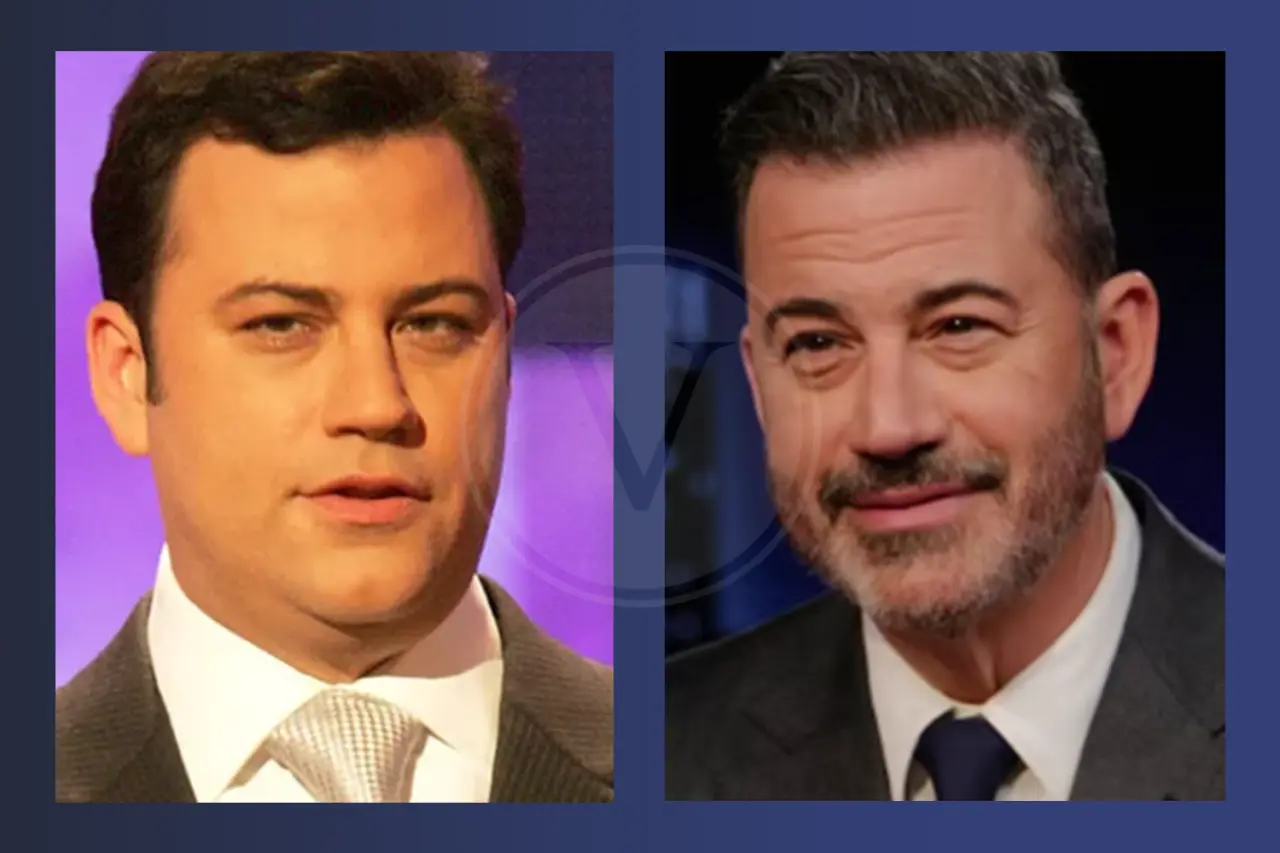 Jimmy Kimmel Before and After Hair Transplant
