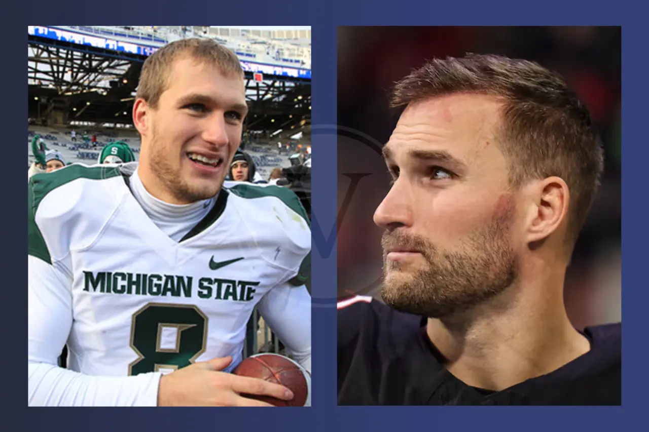 Kirk Cousins Before and After Hair Transplant