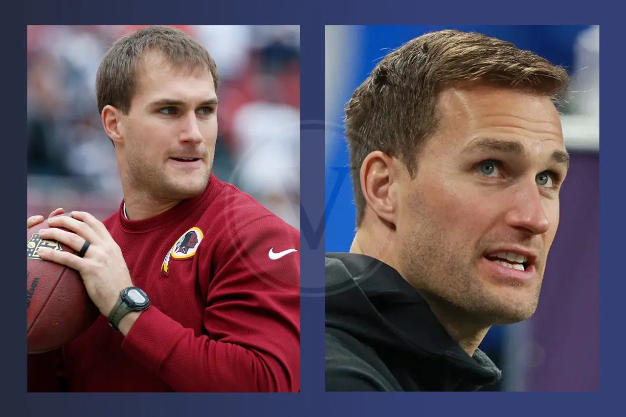 Kirk Cousins Before and After Hair Transplant