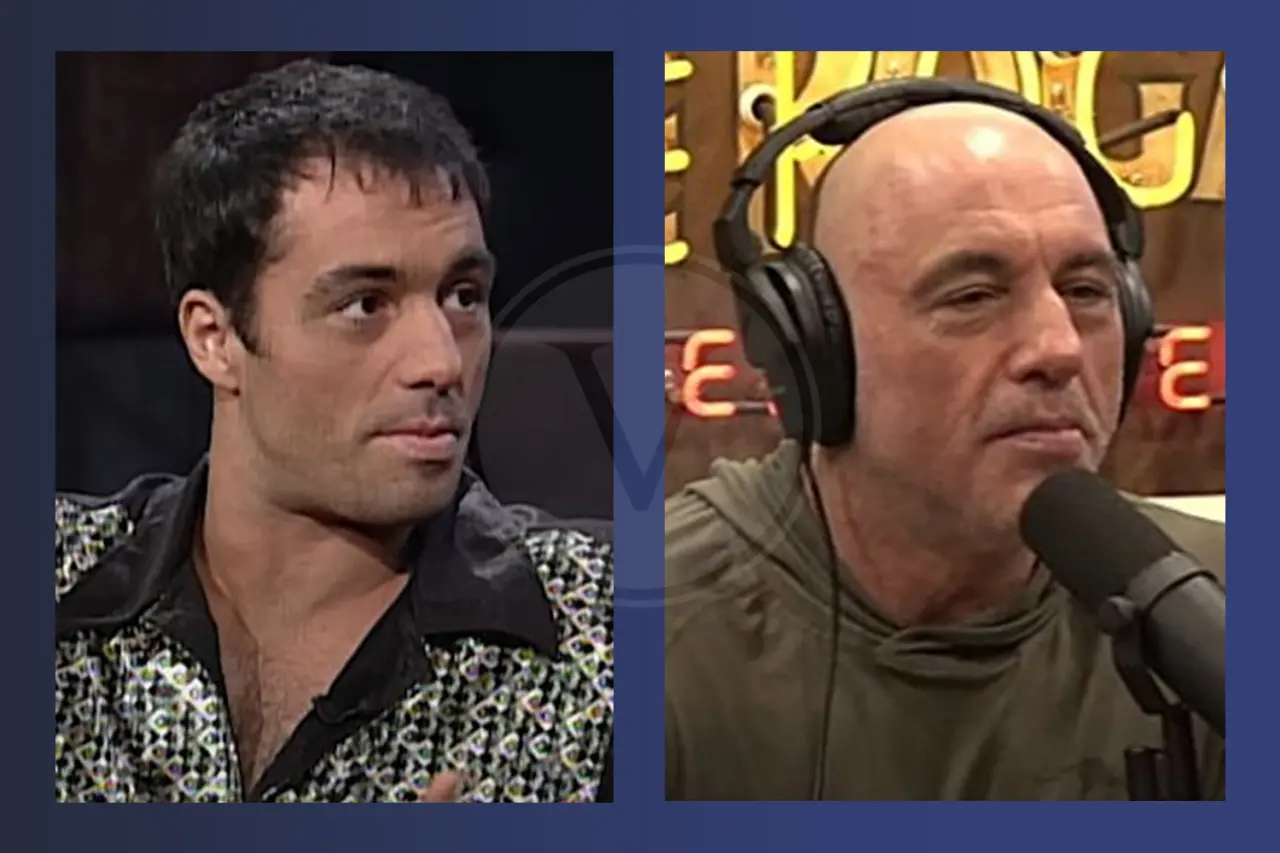 Joe Rogan Before and After Hair Transplant