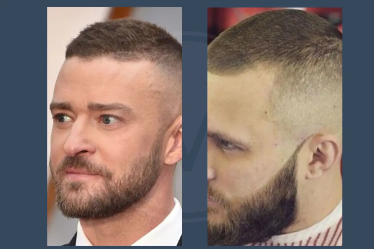 Crew Cut for Balding Men