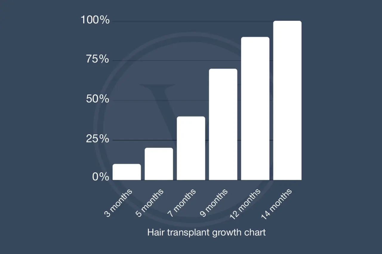 Hair Transplant Recovery Month by Month