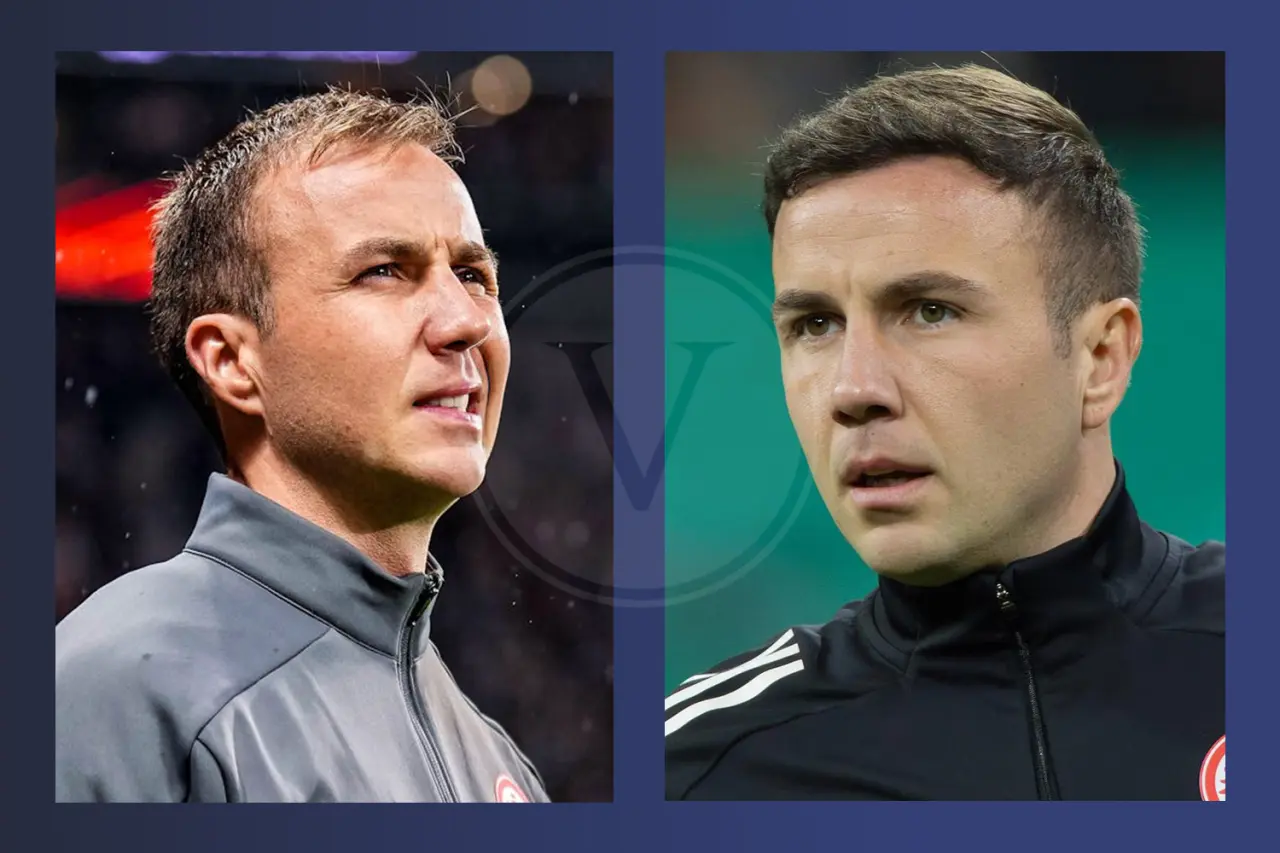 Mario Götze Haartransplantation: Vorher und Nachher