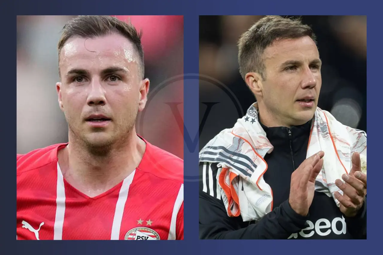 Mario Götze Haartransplantation: Vorher und Nachher