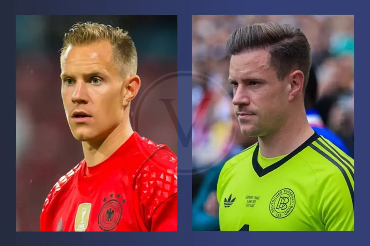 Ter Stegen Haartransplantation: Vorher und Nachher