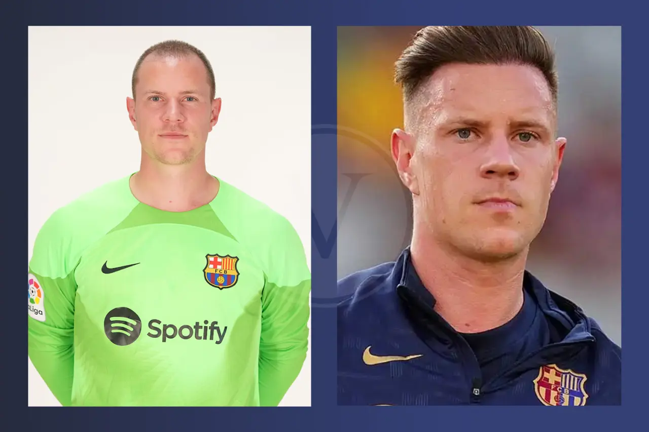Ter Stegen Haartransplantation: Vorher und Nachher