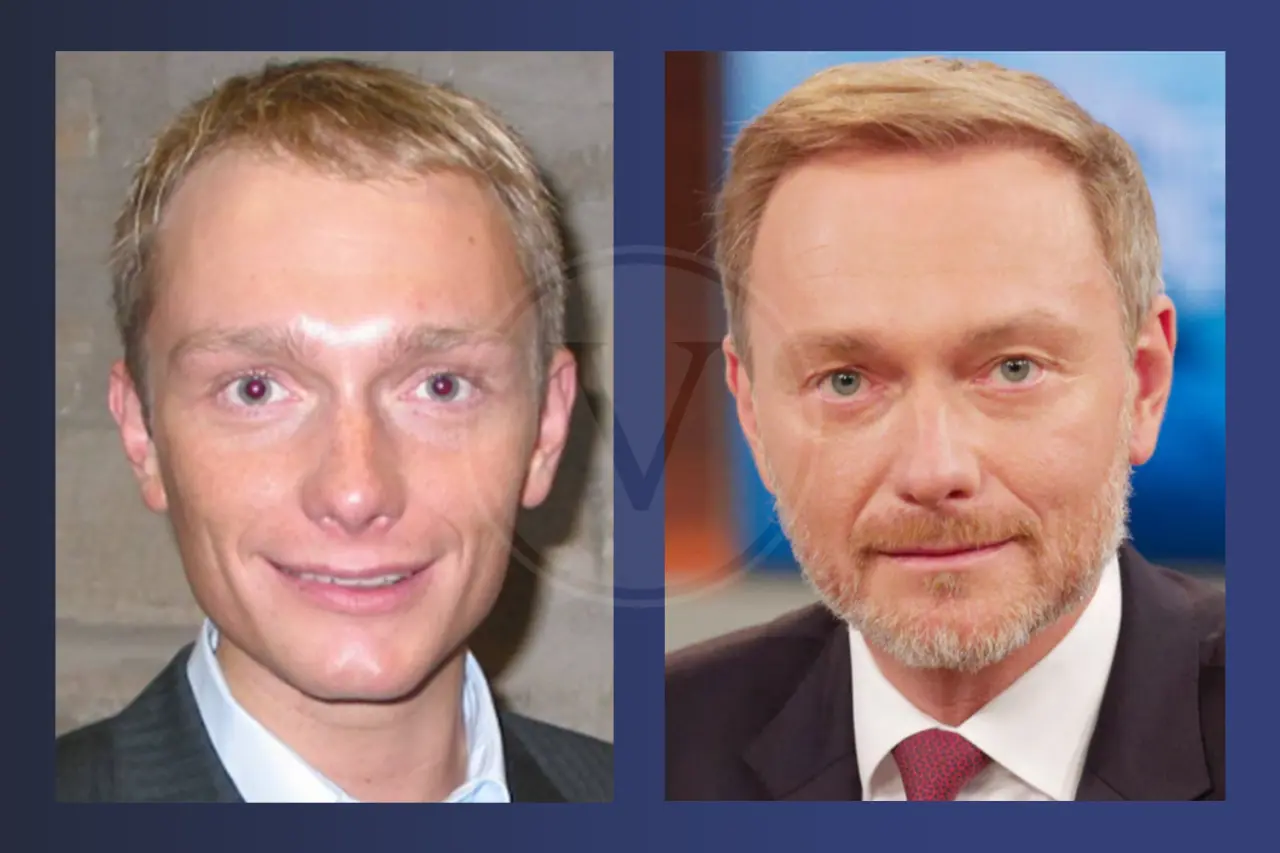 Christian Lindner Haartransplantation: Vorher und Nachher