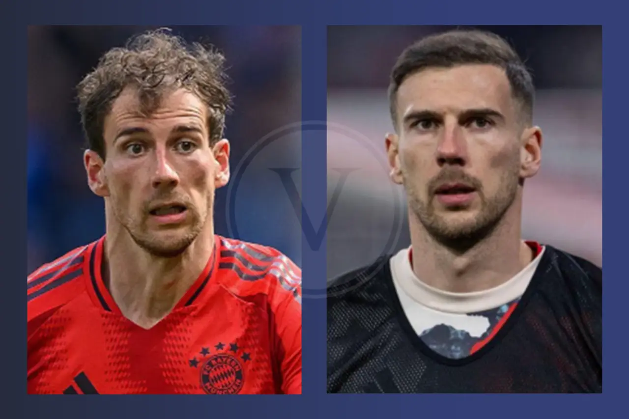 Promis mit Haartransplantation: Vorher - Nachher