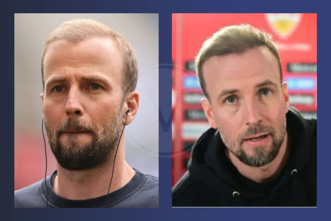 Sebastian Hoeneß Haare Vorher & Nachher Haartransplantation