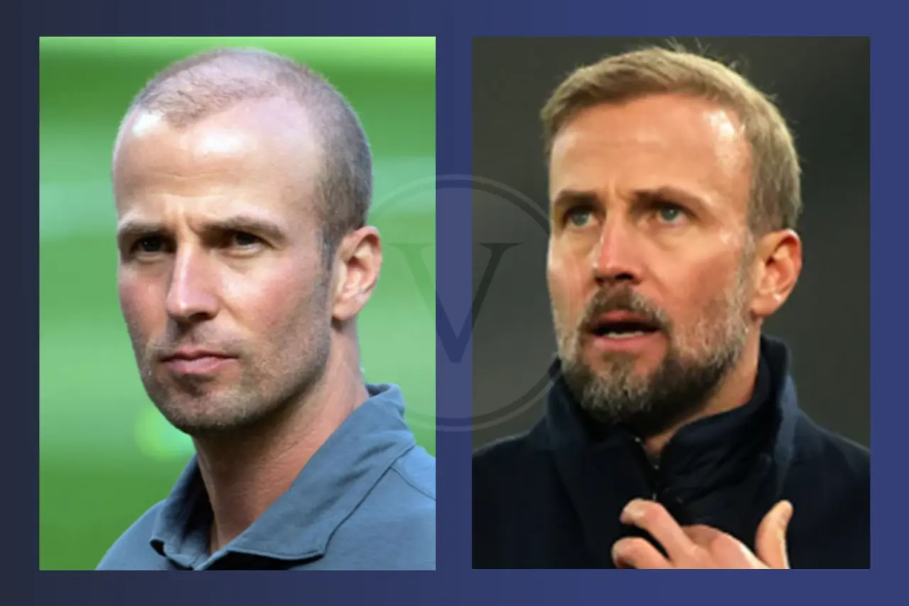 Sebastian Hoeneß Haare Vorher & Nachher Haartransplantation