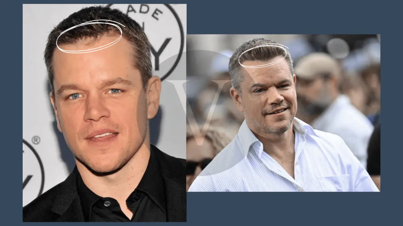 Matt Damon’s Hair Journey