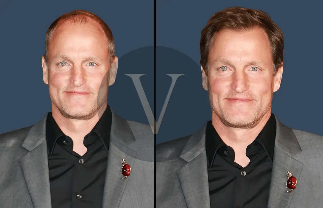 Woody Harrelson Hair