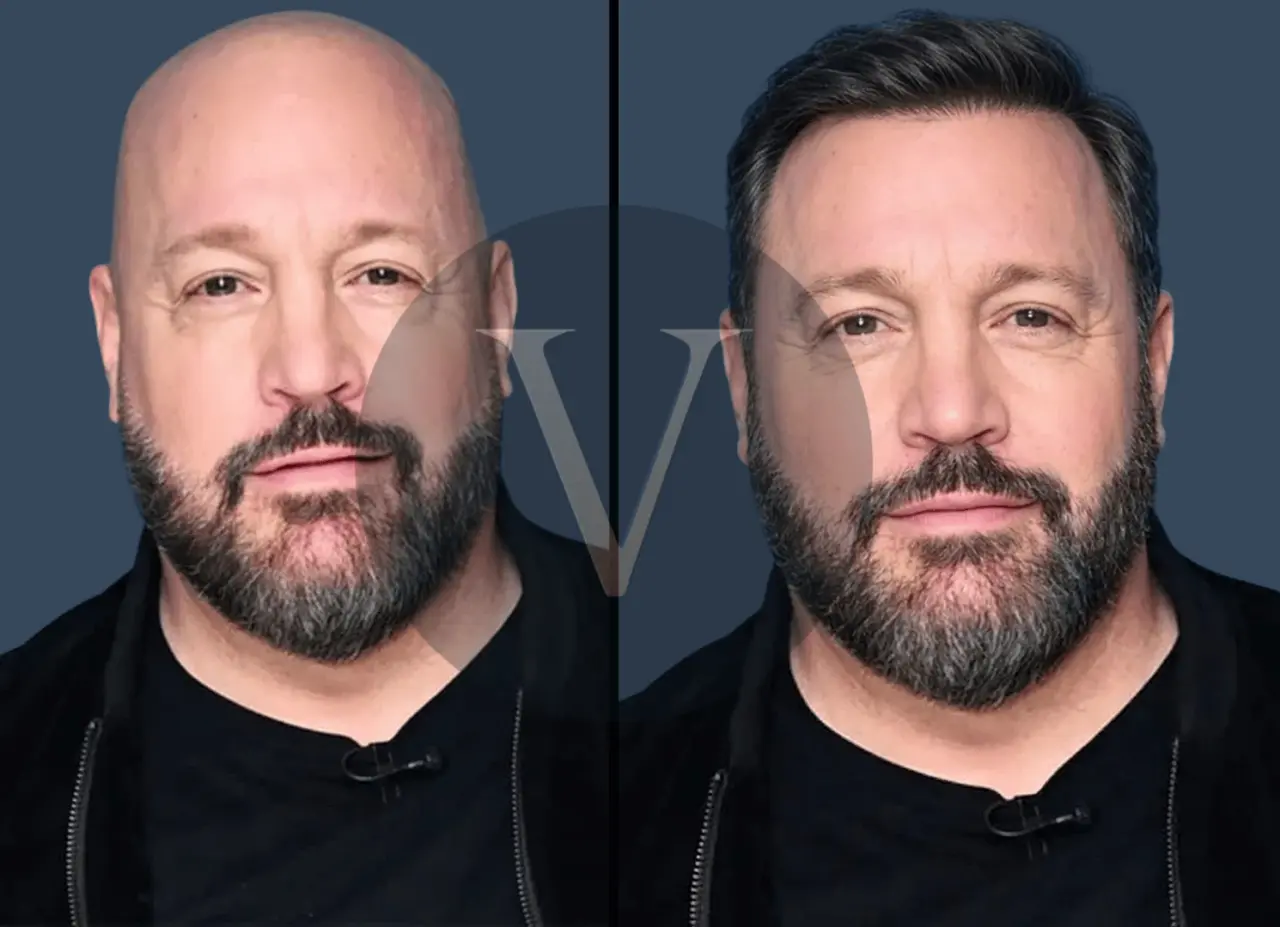 Kevin James Hair