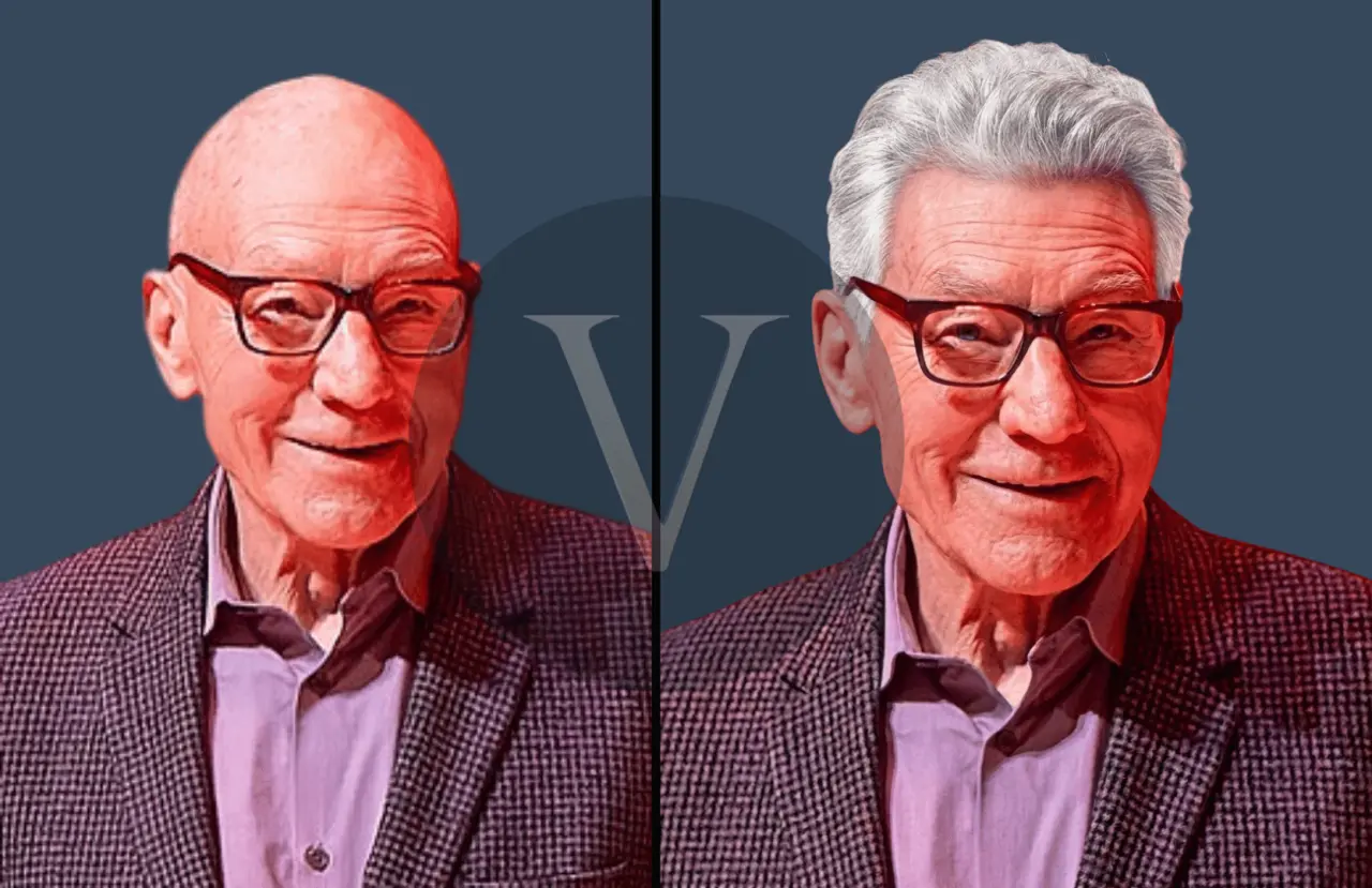 Patrick Stewart Hair