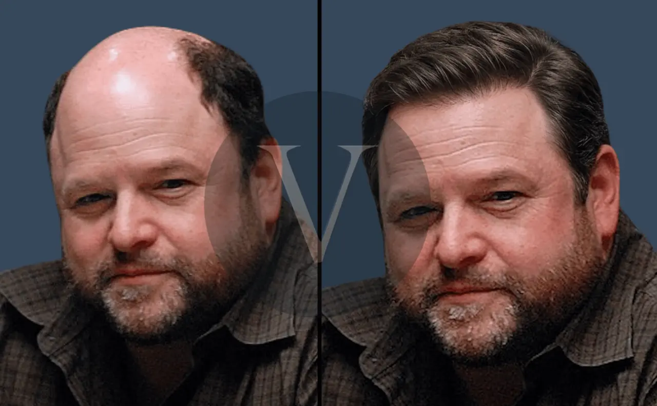 Jason Alexander Hair