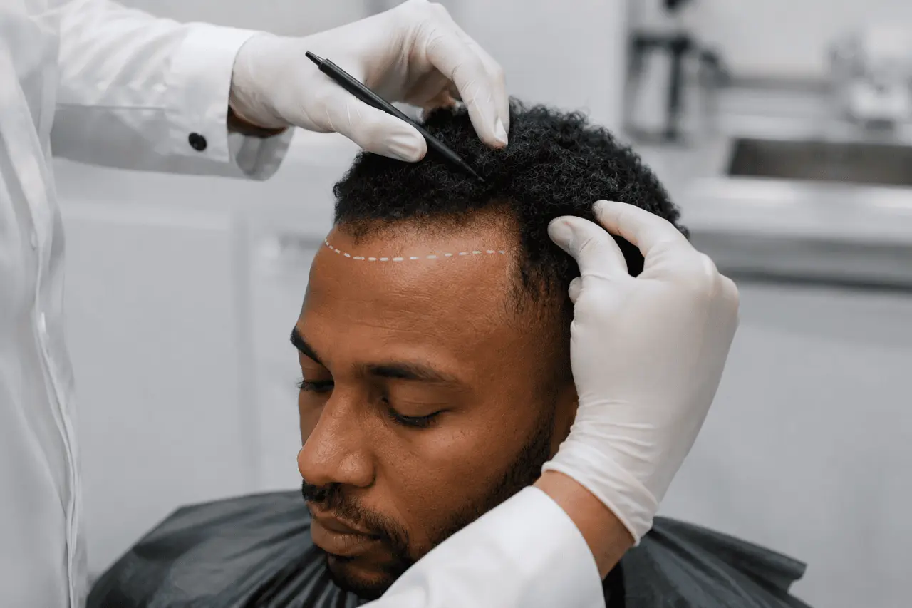 Afro Hair Transplant Recovery Guide