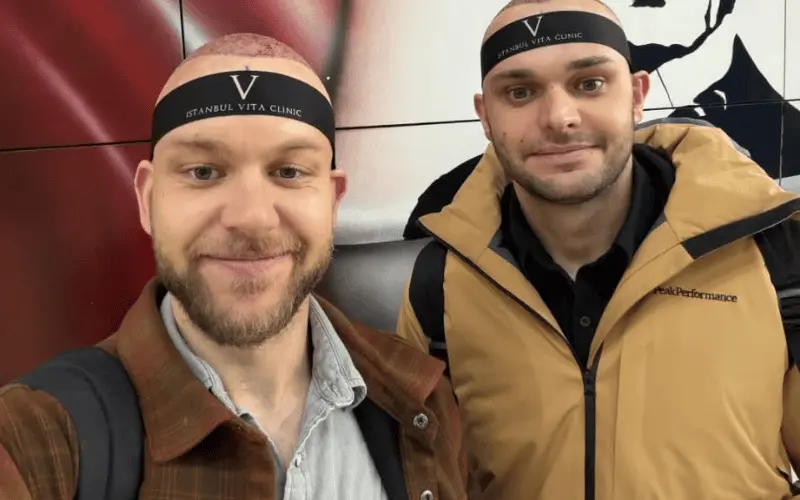 two man done their hair transplant from turkey 