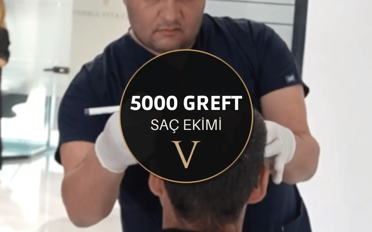 5000 greft saç ekimi