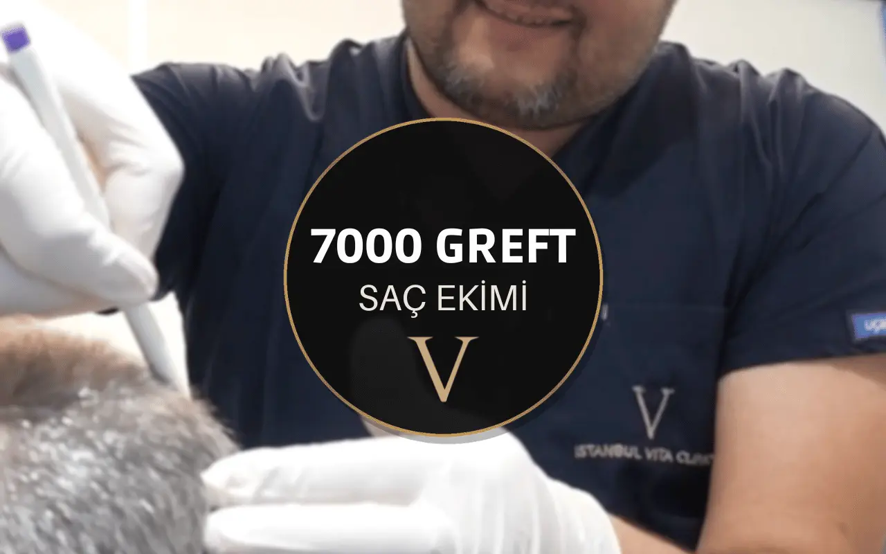 7000 greft saç ekimi fiyatları