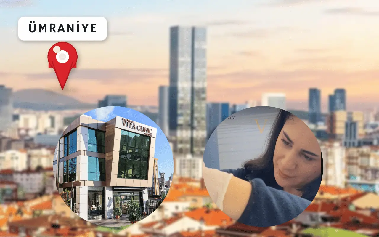 ümraniye saç ekim merkezi 
